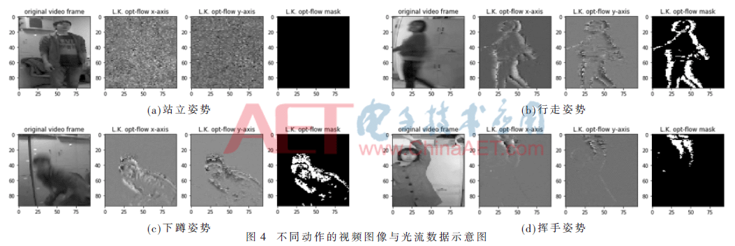 qrs2-t4.gif