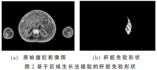 多圖像融合的連續腹腔影像圖像分割